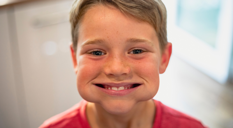 Sådan bevarer du et smukt smil hele livet