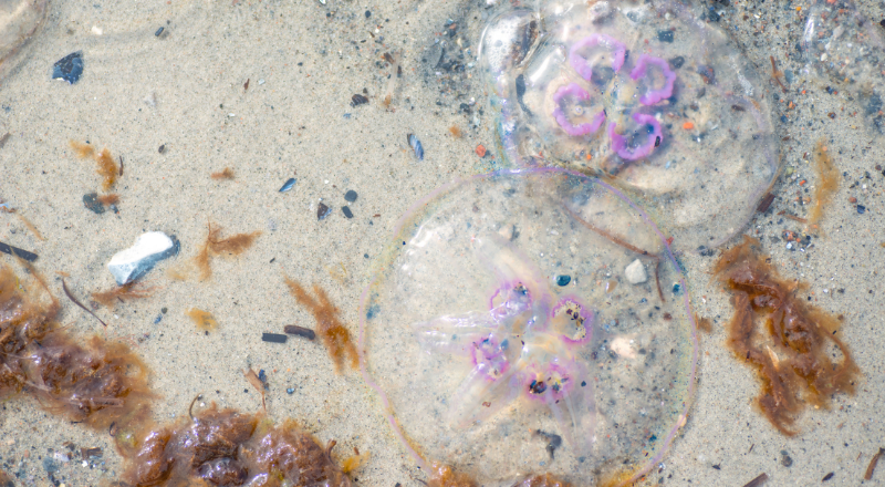 Brændt af en brandmand? Her er 5 gode råd til behandling af sårene