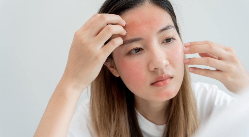 Sådan undgår din teenager parfumeallergi