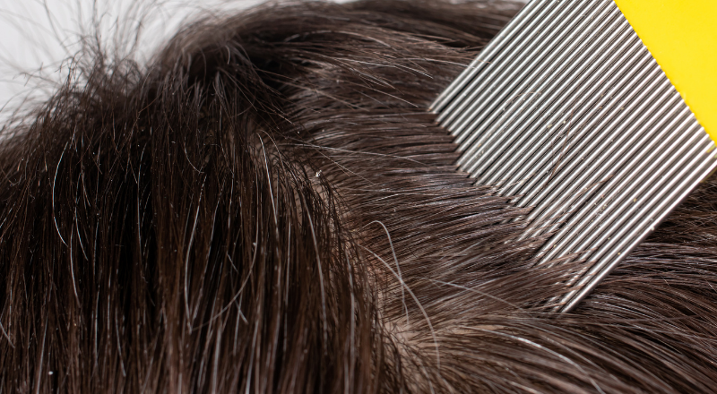 Corona: Er det slut med lus?